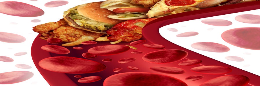کلسترول خون و نقش آن در بروز بیماری قلبی