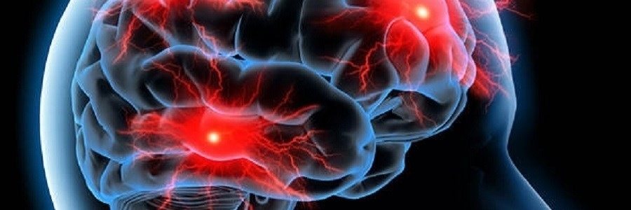 آیا بین عوامل خطر قلبی و جریان خون مغزی همبستگی وجود دارد؟