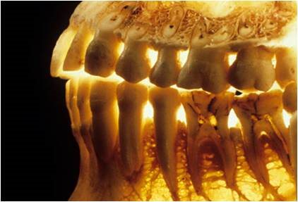 استئوپرز و از دست دادن دندان ها