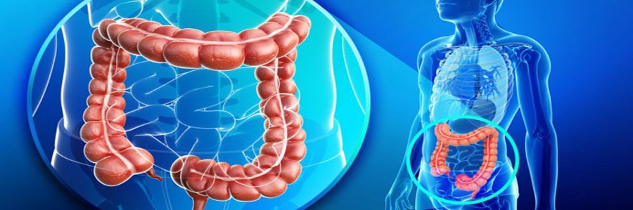 خطر ابتلا به سرطان کولون در عرض دو هفته!