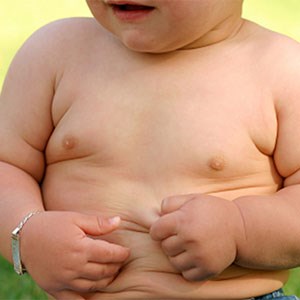 برخی از درمان ها در کودکی خطر ابتلا به چاقی را افزایش می دهد