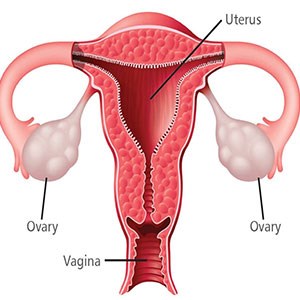 بهبود باروری در زنان مبتلا به سندروم تخمدان پلی کیستیک با کاهش وزن و فعالیت بدنی