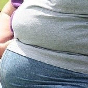 چربی کبدی تعیین کننده سلامت افراد چاق